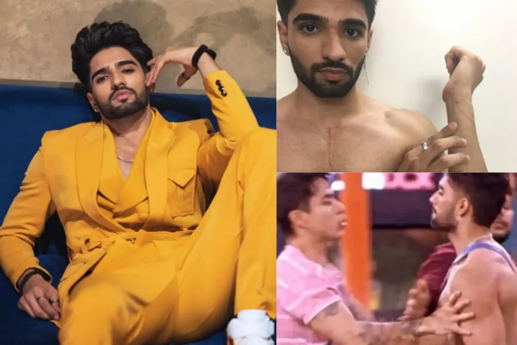 Bigg Boss OTT contestant Zeeshan Khan Shares Scars on Body After Mid-Week Eviction, Fans say Unfair Decision