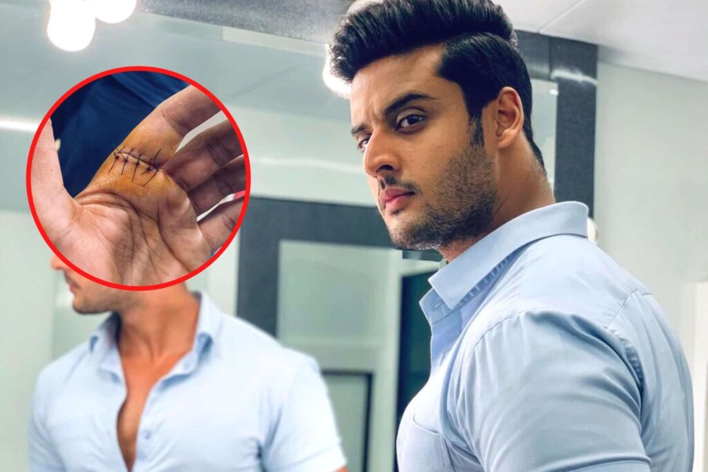 Zee Tv Show Meet actor Shagun Pandey gets injured, gets 3-4 stitches